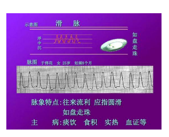 脉诊图解大全完整版二十八种脉象让你轻松掌握脉诊